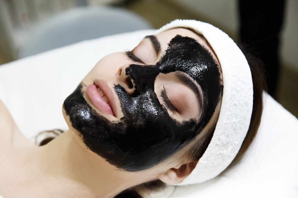 Carbon Laser Peel