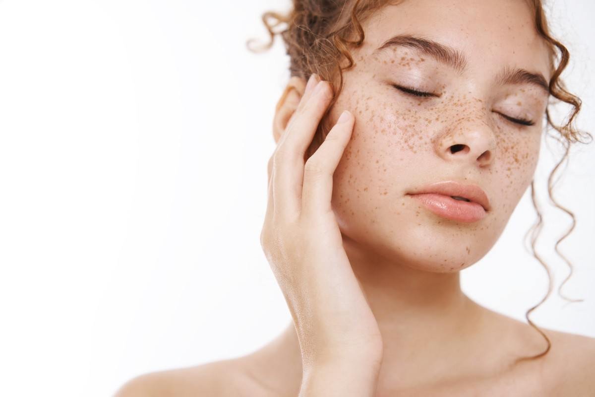 Freckles Treatment